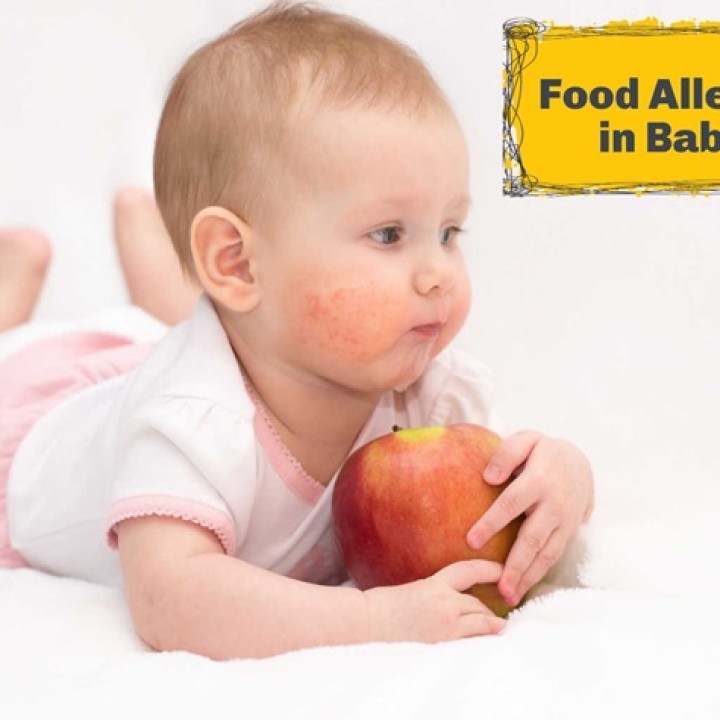 Allergies in Babies: Identifying Triggers and Managing Symptoms