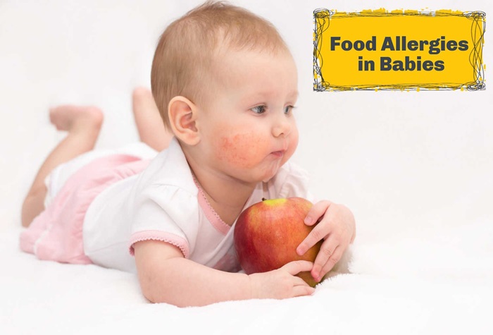 Allergies in Babies: Identifying Triggers and Managing Symptoms